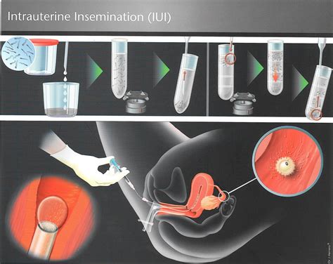 insemination porn|insemination videos .